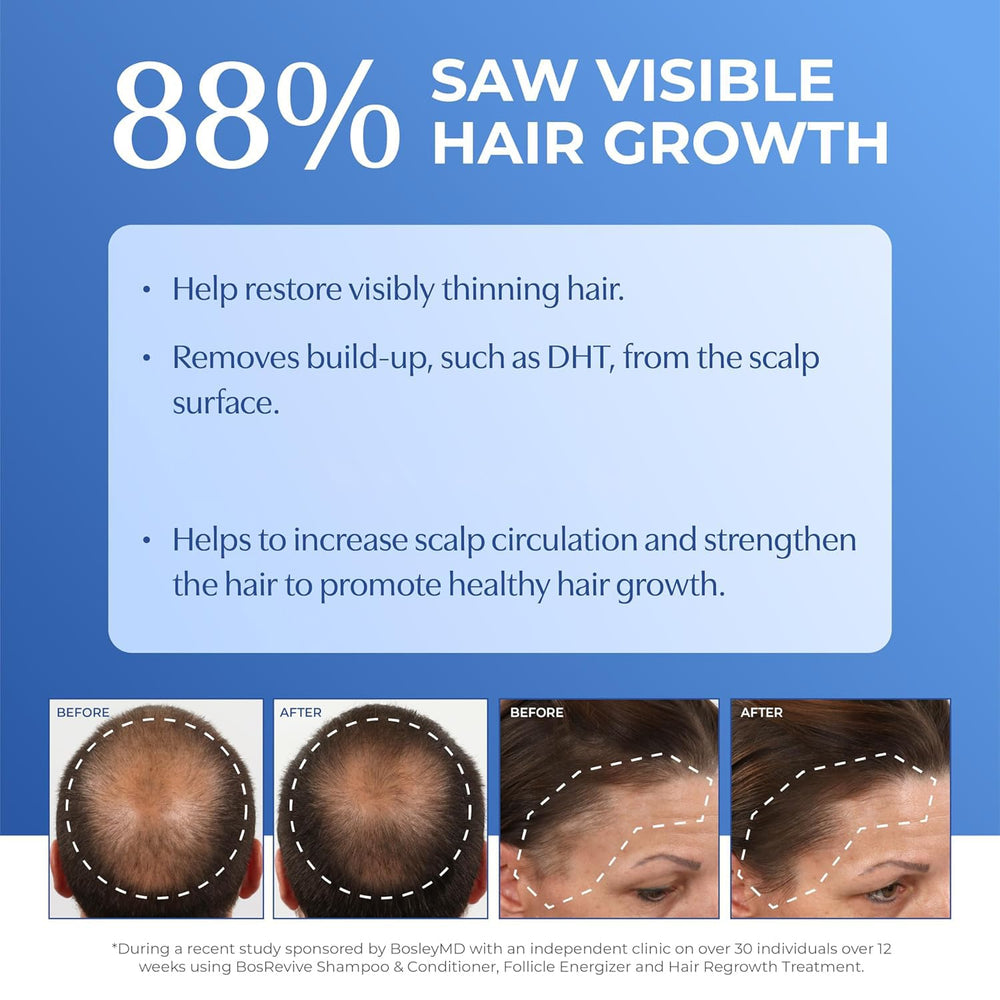 BosleyMD BOSRevive in-use image of woman applying treatment for visible fullness