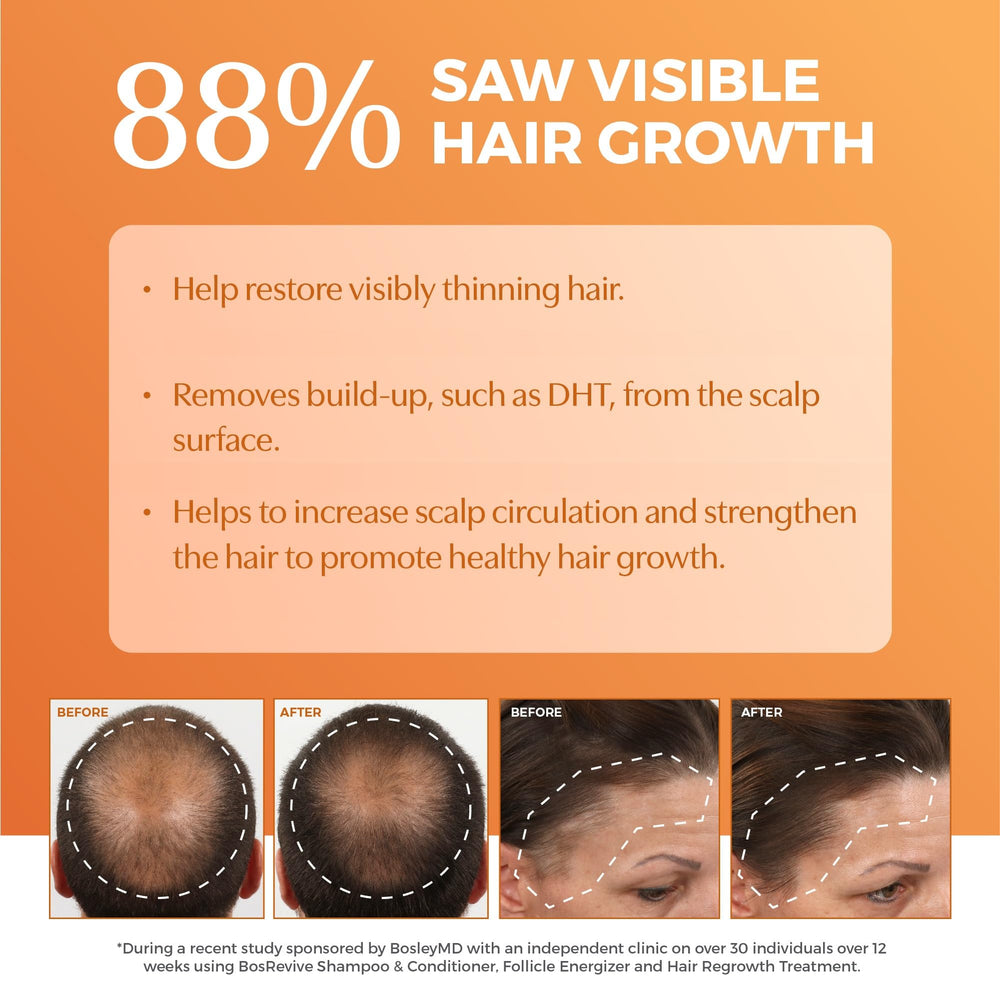 BosRevive before and after comparison illustrating fuller-looking hair effect