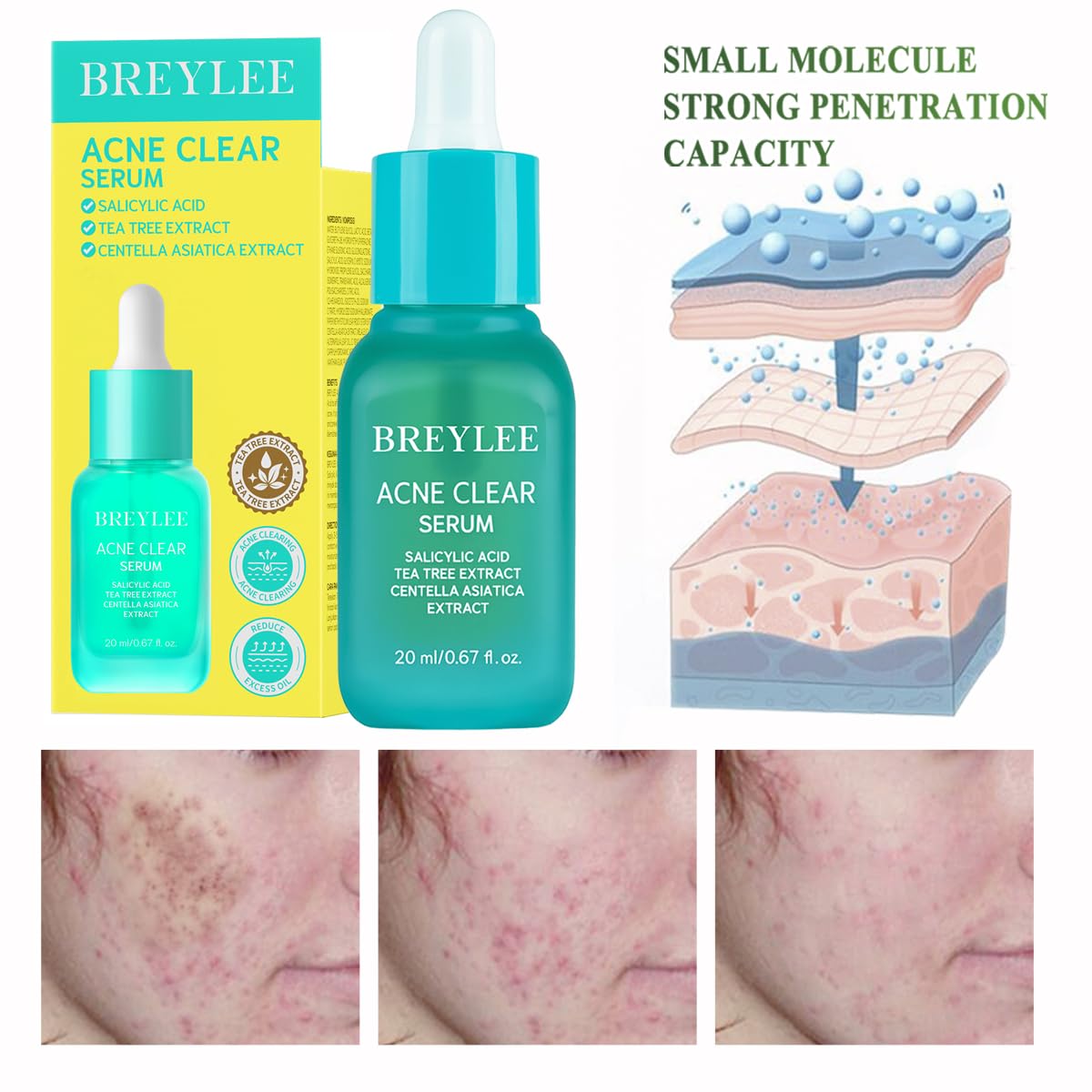BREYLEE serum dropper close-up showing lightweight texture for quick absorption