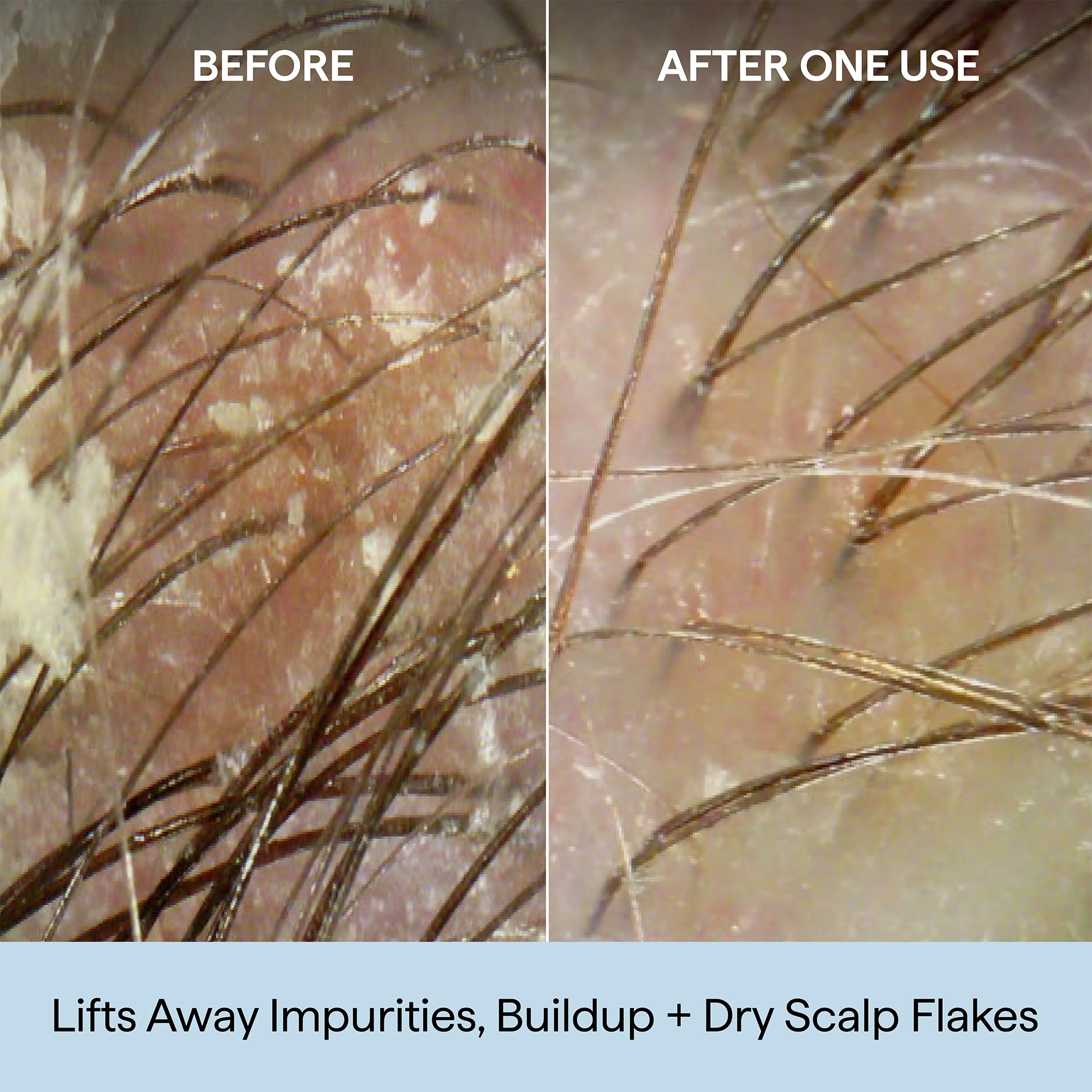 Hand applying Briogeo shampoo to roots for targeted exfoliation