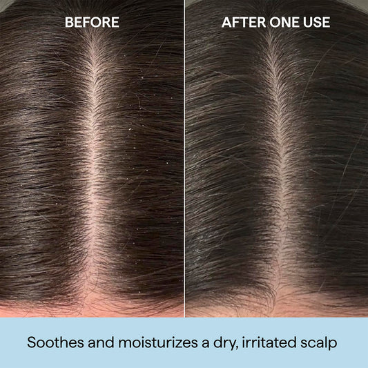 Briogeo oil texture on dropper highlighting lightweight hydration