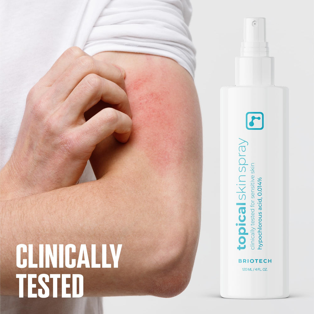 BRIOTECH applied to foot showcasing targeted irritation relief