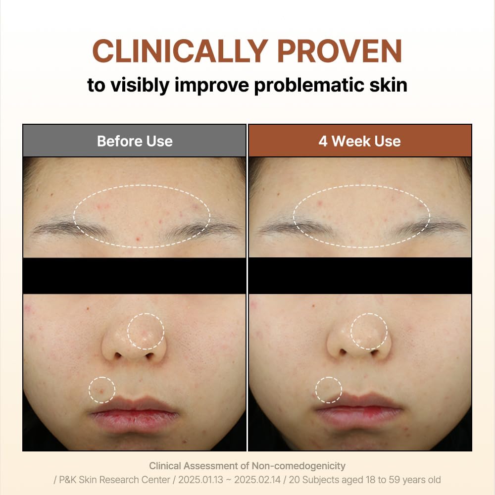 By Wishtrend skin before and after visualization showing texture improvement benefit