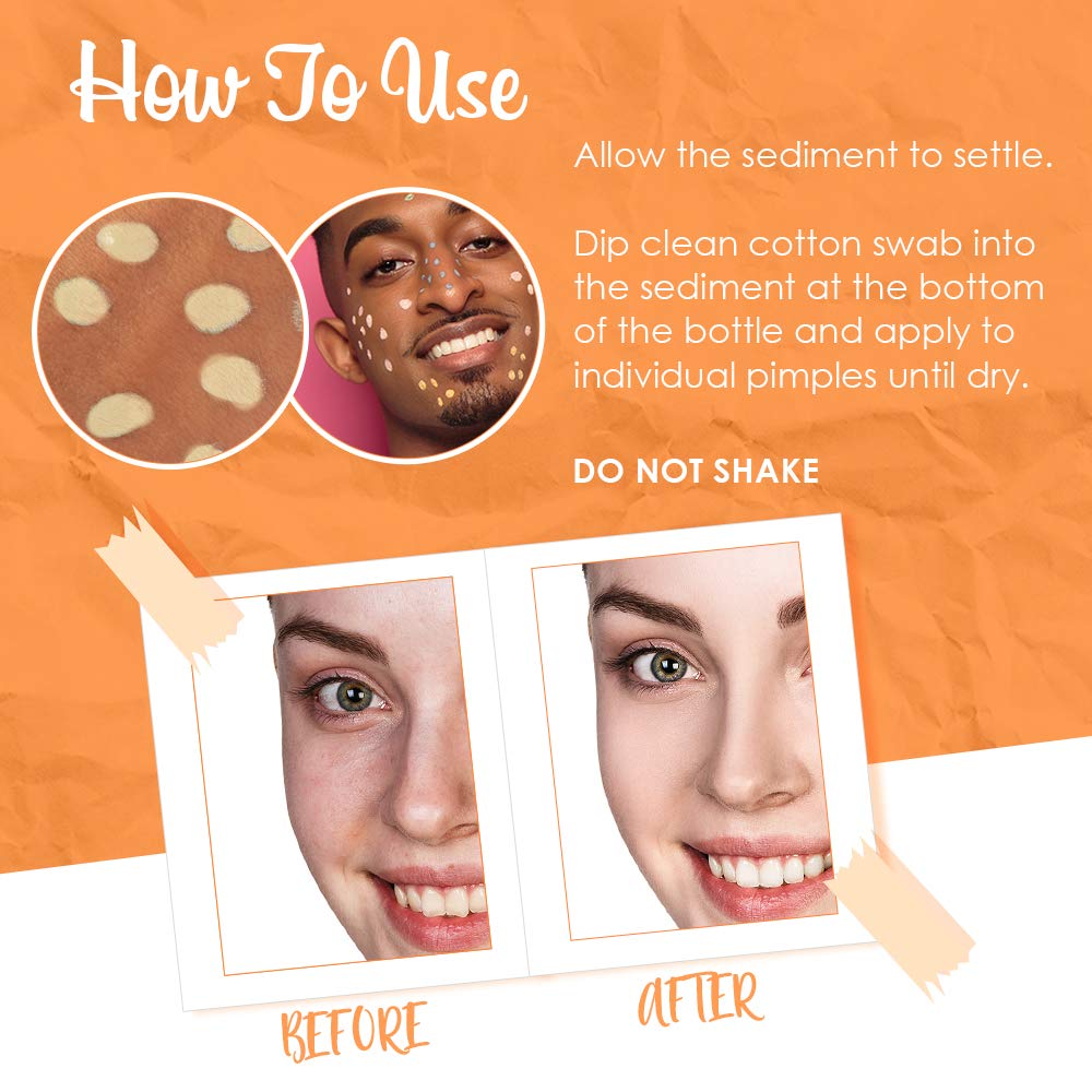 Bye Bye Blemish bottle on bathroom shelf in routine setup suggesting easy daily use