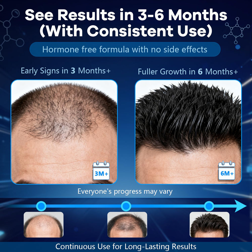 CARENICE label close-up highlighting minoxidil and biotin content