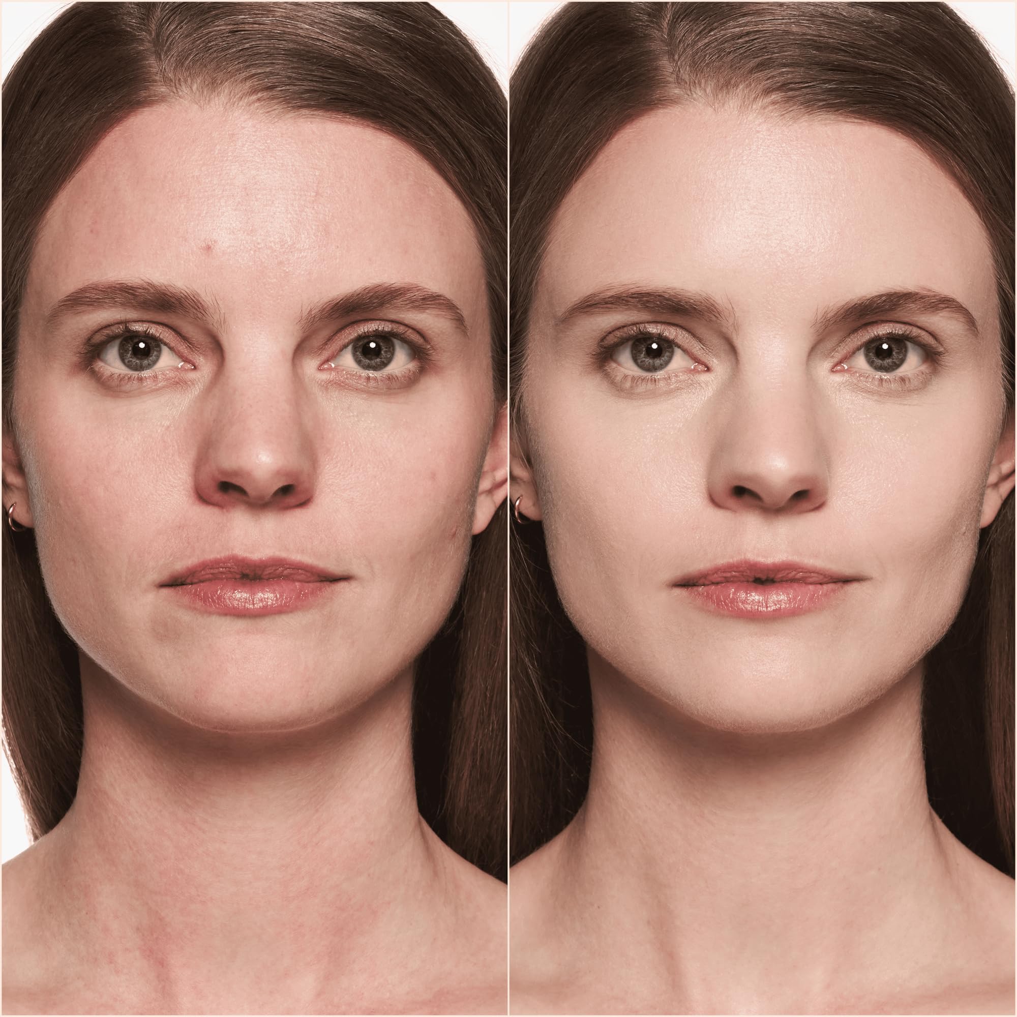 Catrice before and after on face showing visible coverage benefit