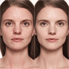 Catrice before and after on face showing visible coverage benefit