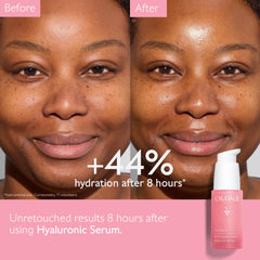 Caudalie VinoHydra pipette dispensing serum for precise hydration dosing