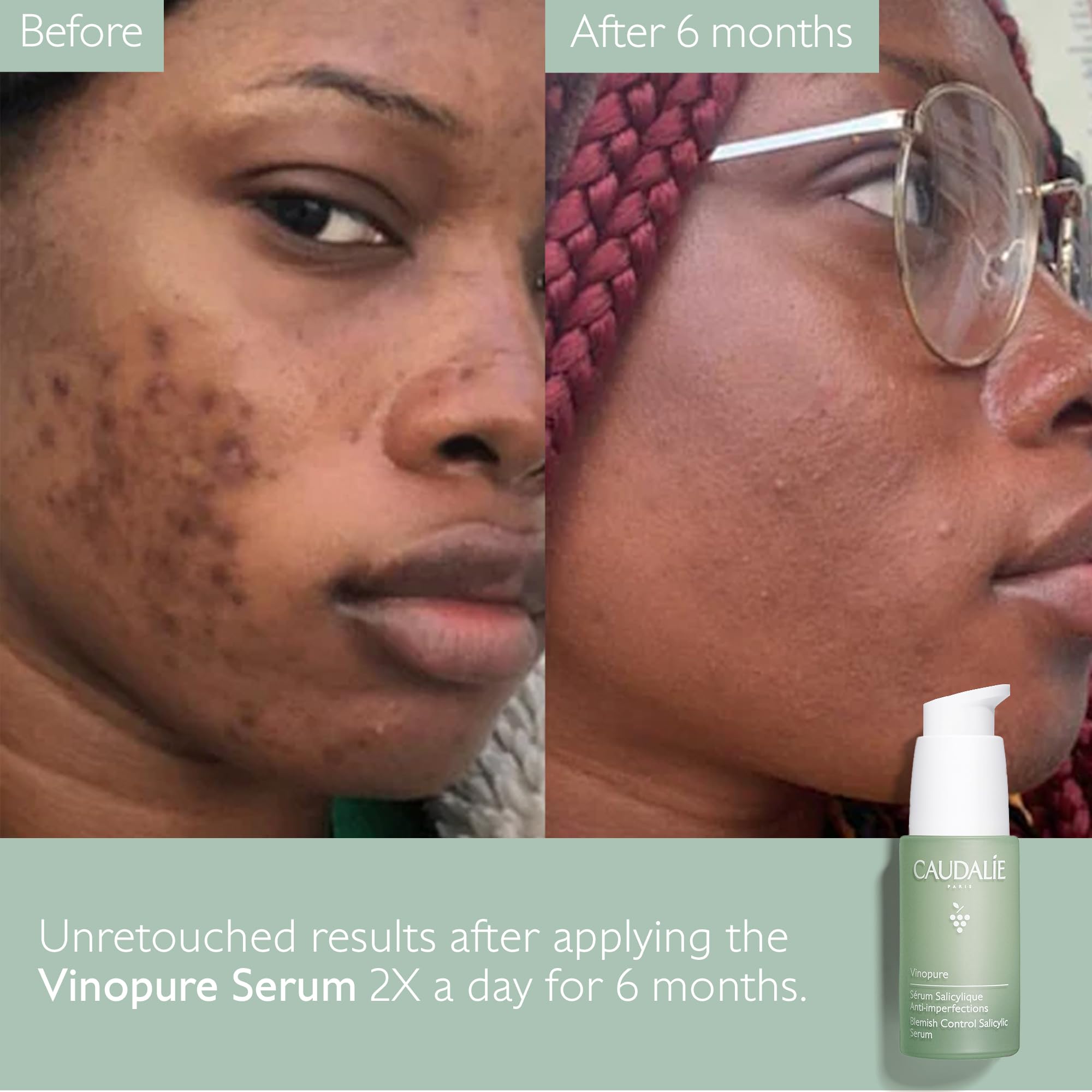 Grapeseed visuals beside product highlighting Caudalie antioxidant protection