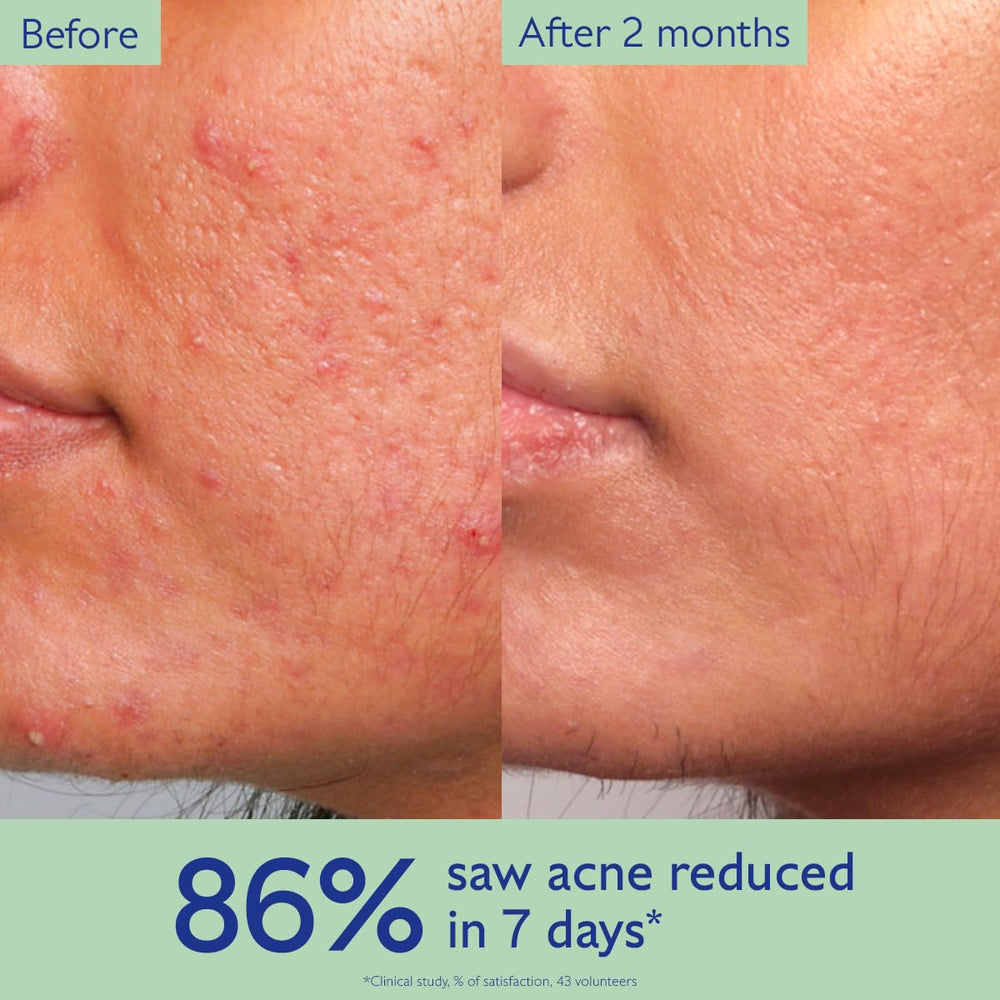 Caudalie Vinopure label close-up listing active ingredients and benefits