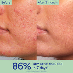 Caudalie Vinopure label close-up listing active ingredients and benefits