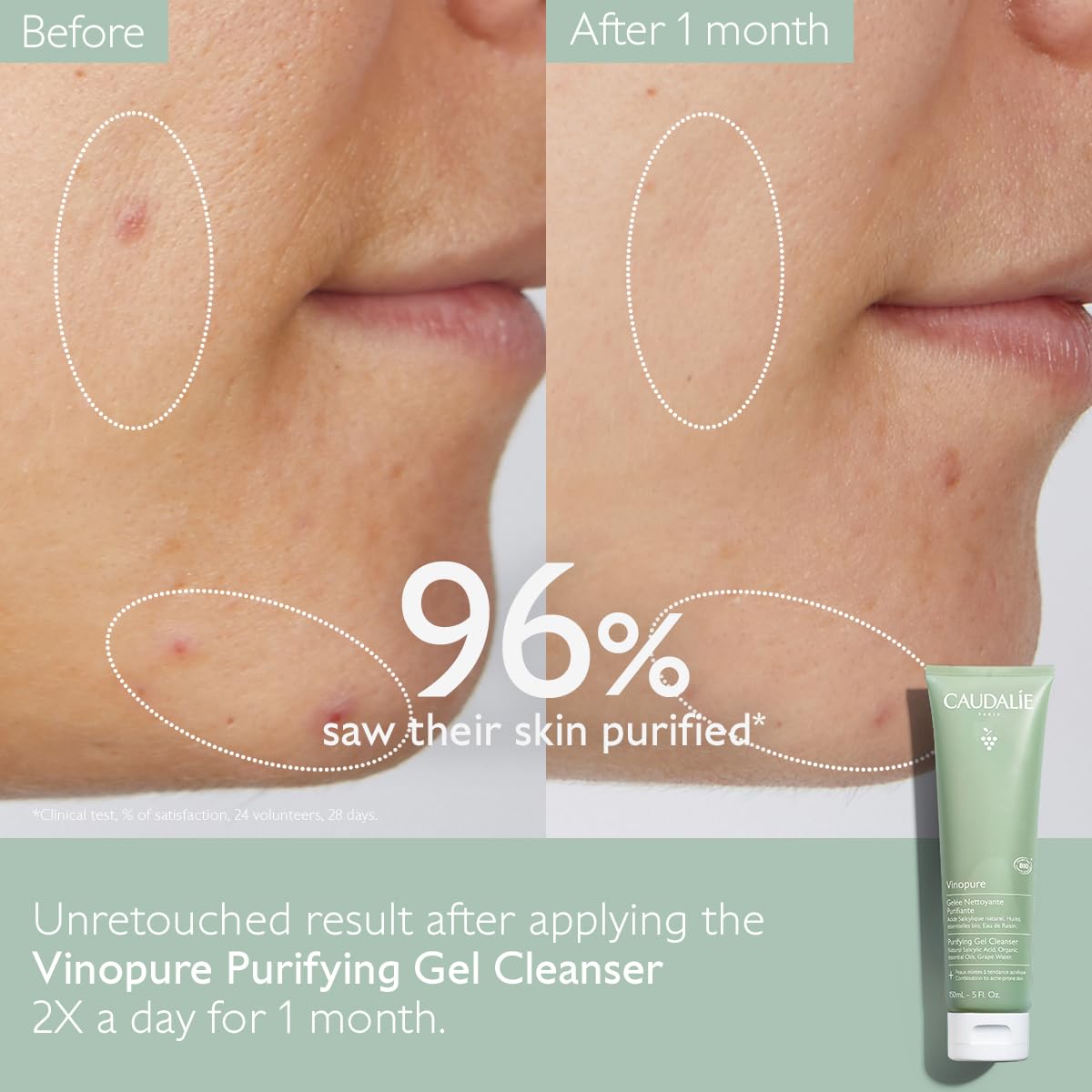 Caudalie Vinopure ingredient label view showing salicylic acid and grape water benefit