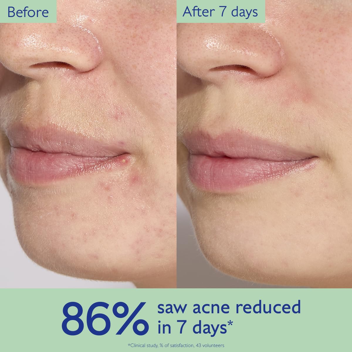 Caudalie Vinopure pump dispensing serum, precise dosage benefit
