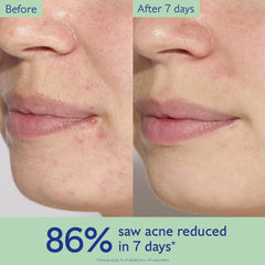 Caudalie Vinopure pump dispensing serum, precise dosage benefit