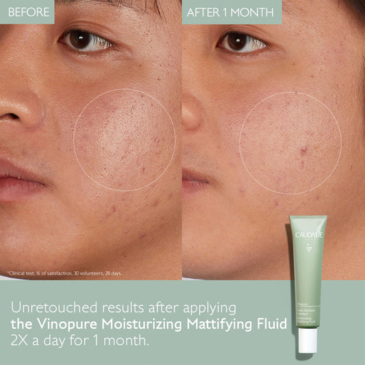 Caudalie Vinopure gel texture close-up illustrating lightweight hydrating finish