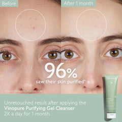 Close-up of Caudalie Vinopure gel texture highlighting gentle exfoliation benefit