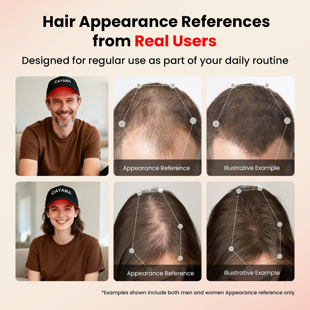 CAYAMA next to a hand for scale illustrating cap size and full-scalp coverage