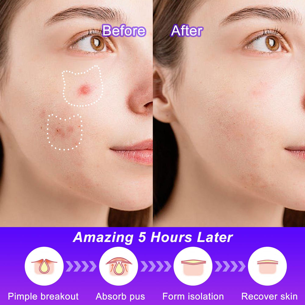 CELECARE patch applied on cheek showing discreet coverage and protection