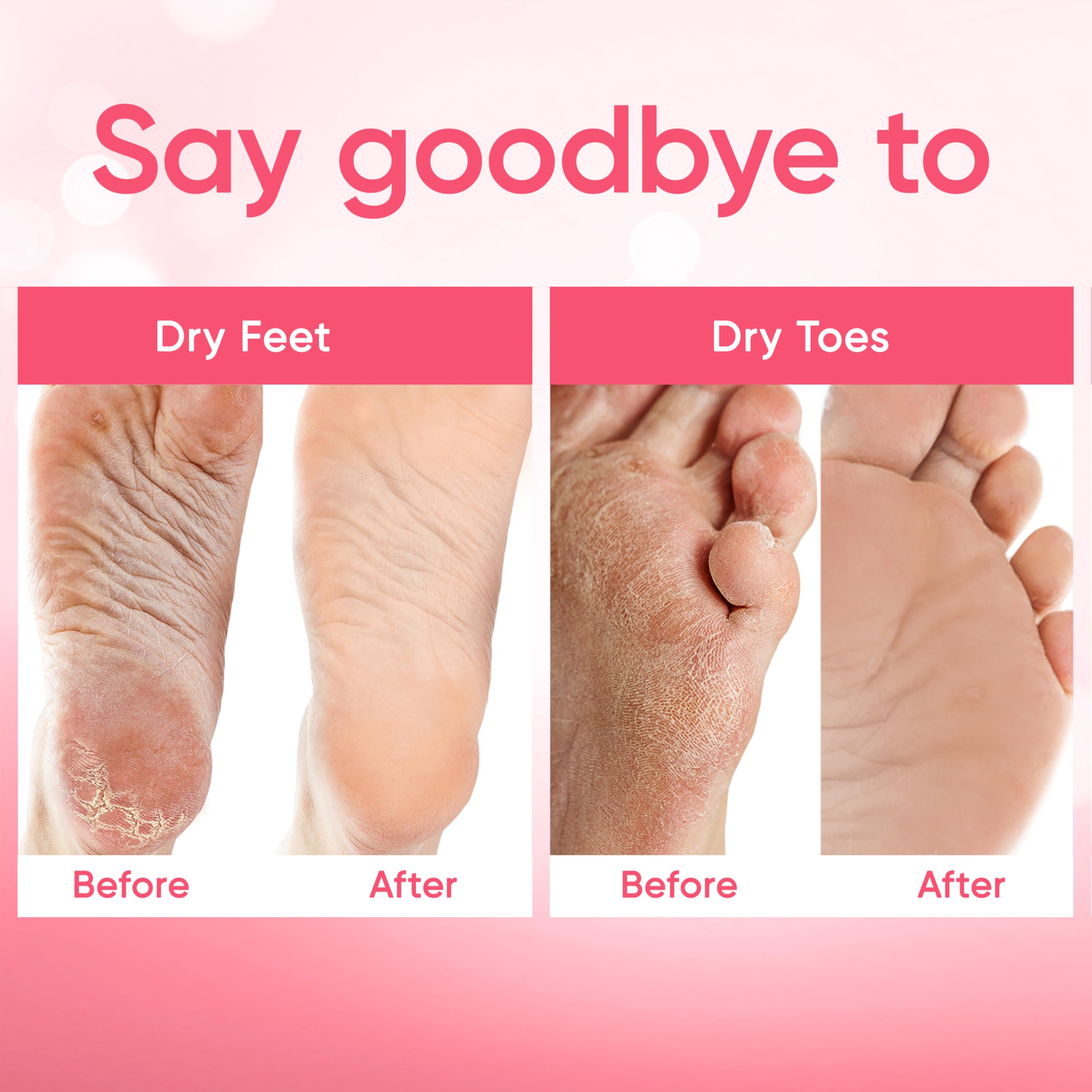 CÉLOR after results with visibly softer feet and renewed skin