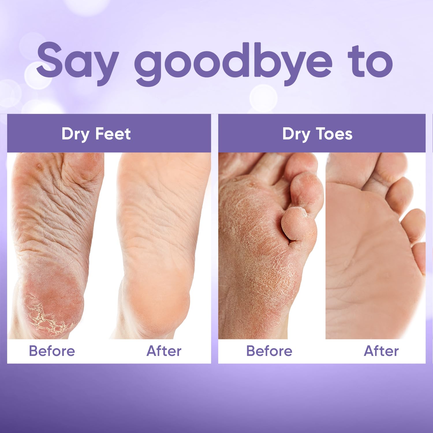 CÉLOR after-treatment smooth feet showing softer heels and visible improvement benefit