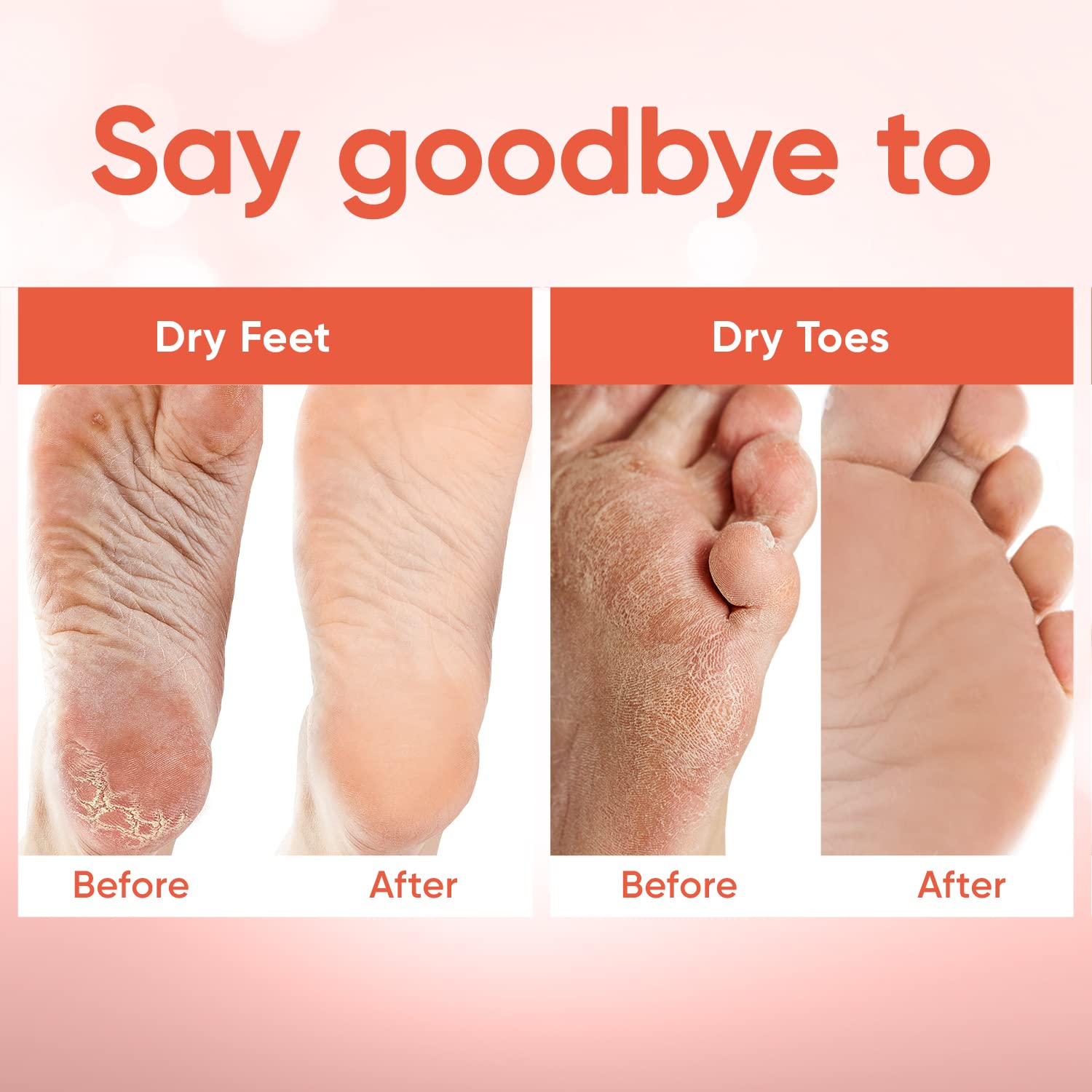 CÉLOR before and after feet showing smoother heels, illustrates visible exfoliation benefit