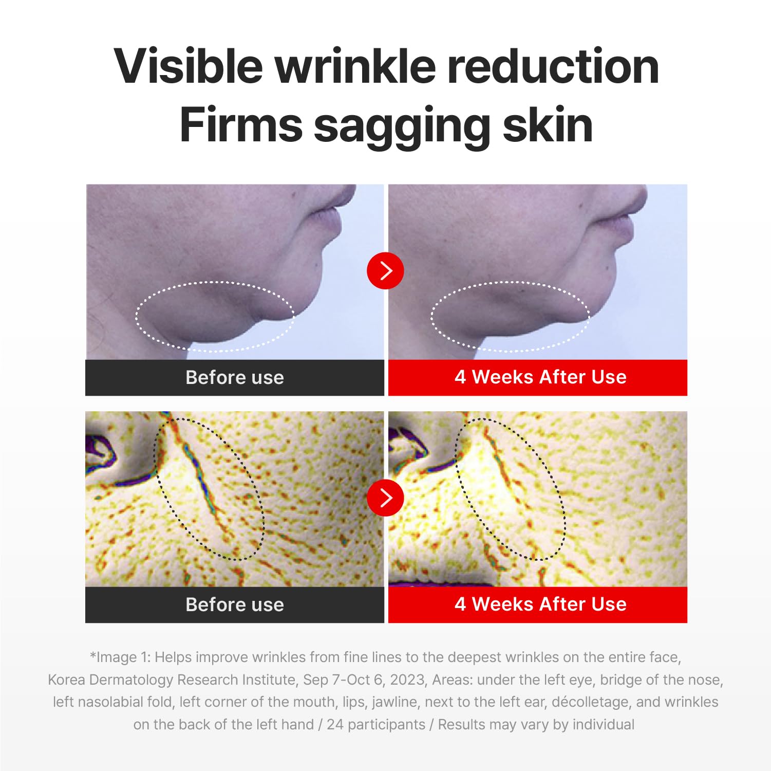 CENTELLIAN 24 application on cheek and forehead showing hydration boost