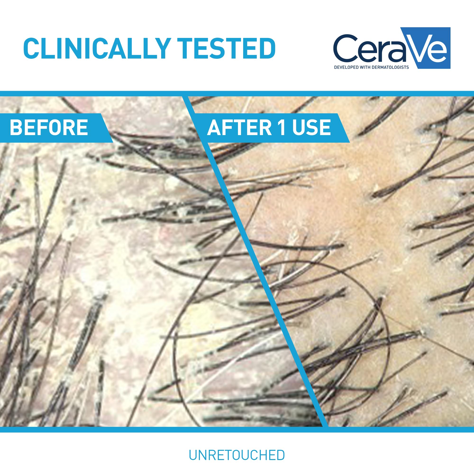 CeraVe creamy lather texture demonstrating gentle hydration benefit
