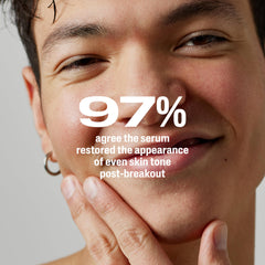 Applying Cetaphil serum to cheek to show smooth application and calming benefit