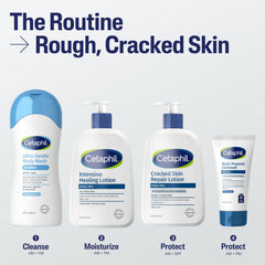 Lotion applied to feet and elbows to hydrate very rough skin