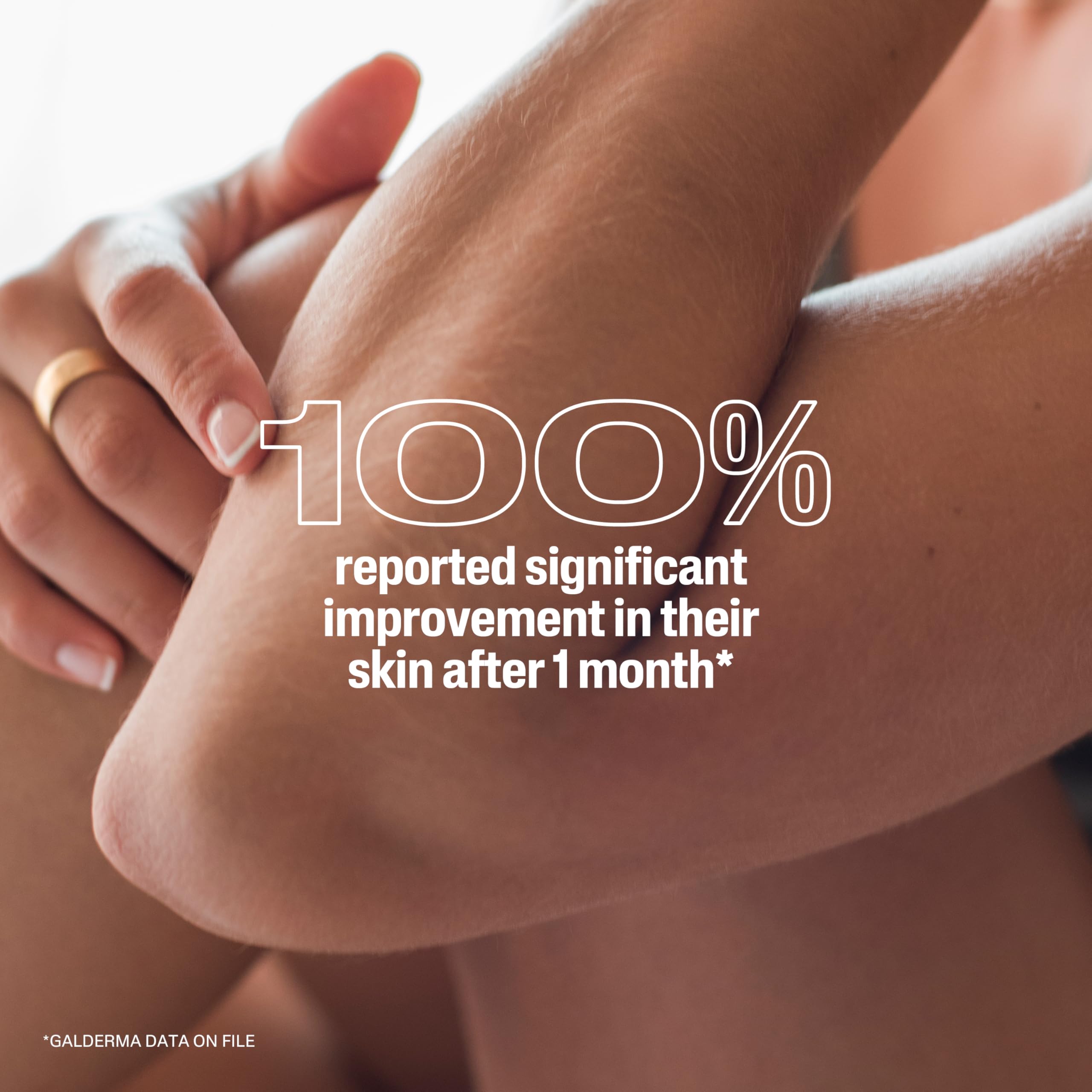 Close-up of urea and dimethicone ingredient callout for hydration