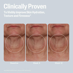 Woman applying Cetaphil to neck showing firmer-looking skin benefit