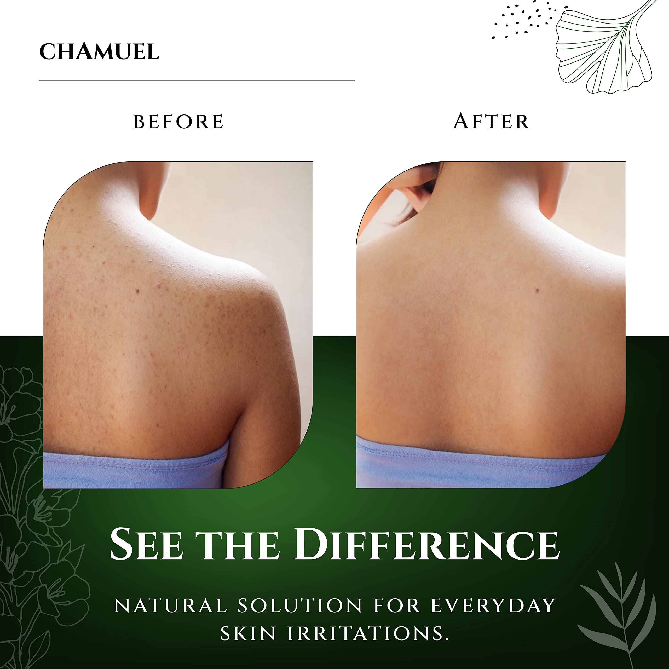 Chamuel gel texture close-up highlighting soothing aloe and oils