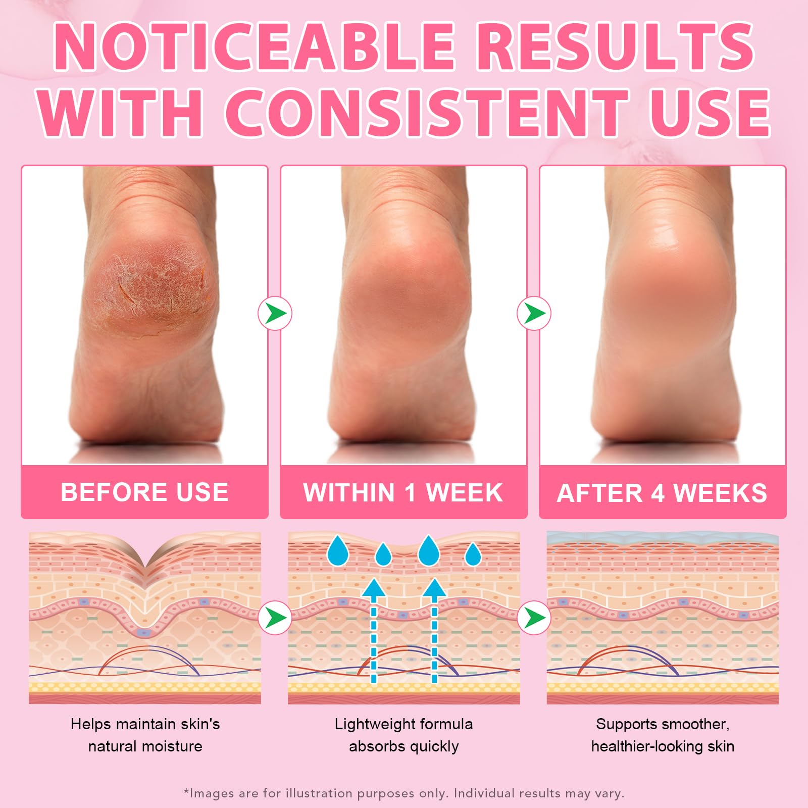 chenyayun applied to heel inside sock showing softening benefit