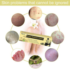 Cherioll cream applied to hands demonstrating absorption and instant comfort