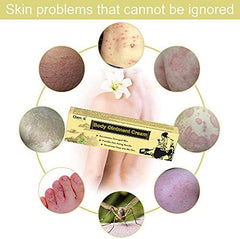 Cherioll size comparison in hand illustrating compact, portable cream suitable for travel