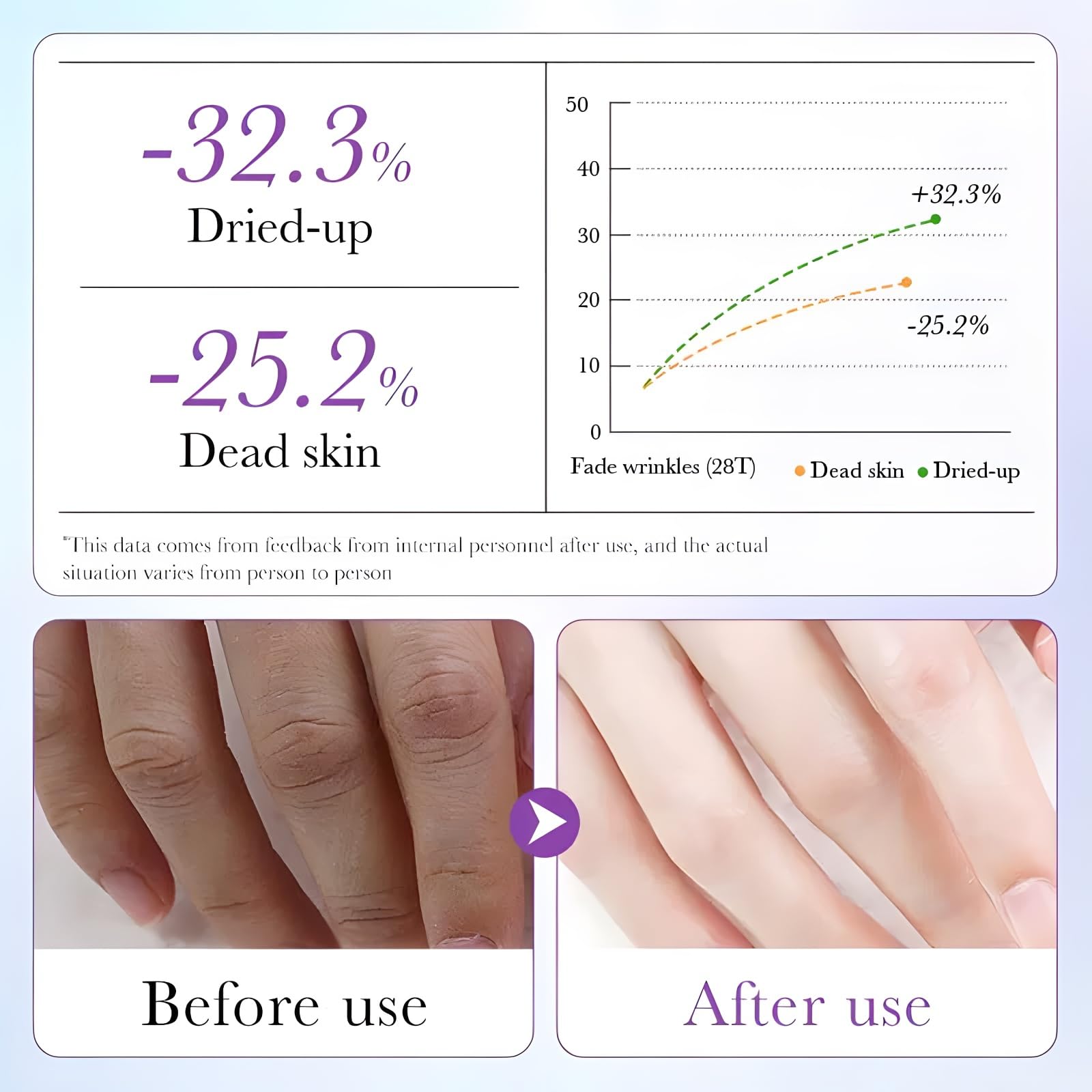 Chicwe hand wearing glove during treatment demonstrating easy use