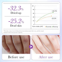 Chicwe hand wearing glove during treatment demonstrating easy use