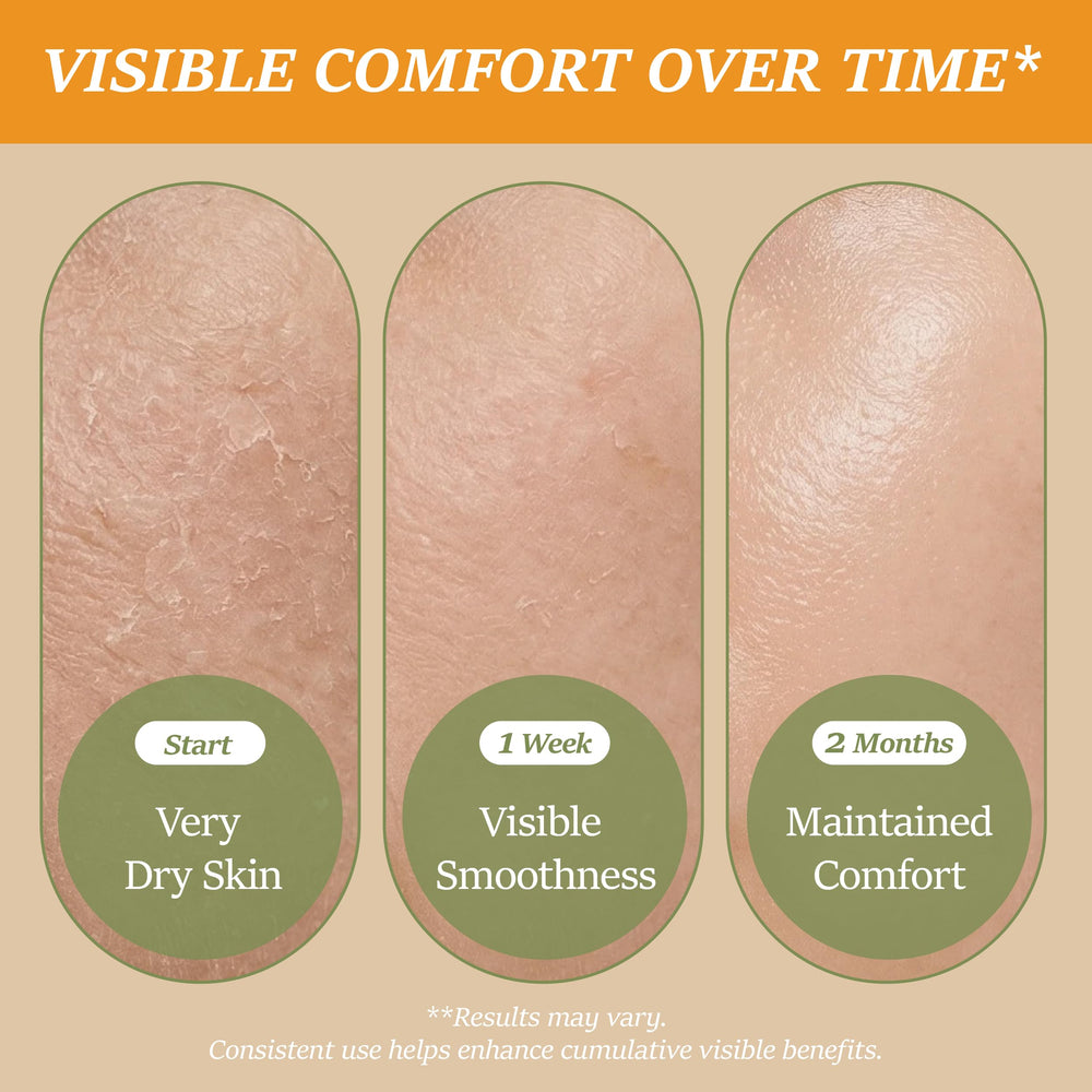 ChiroLife balm dabbed on lips for instant softening and protective feel