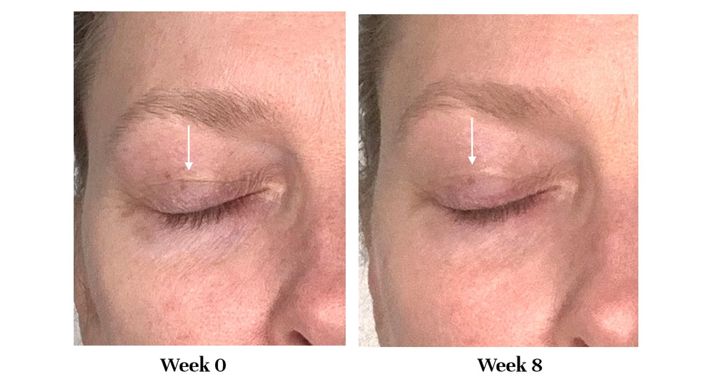 City Beauty tube top with product dispensed for precise eyelid application