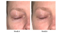 City Beauty tube top with product dispensed for precise eyelid application