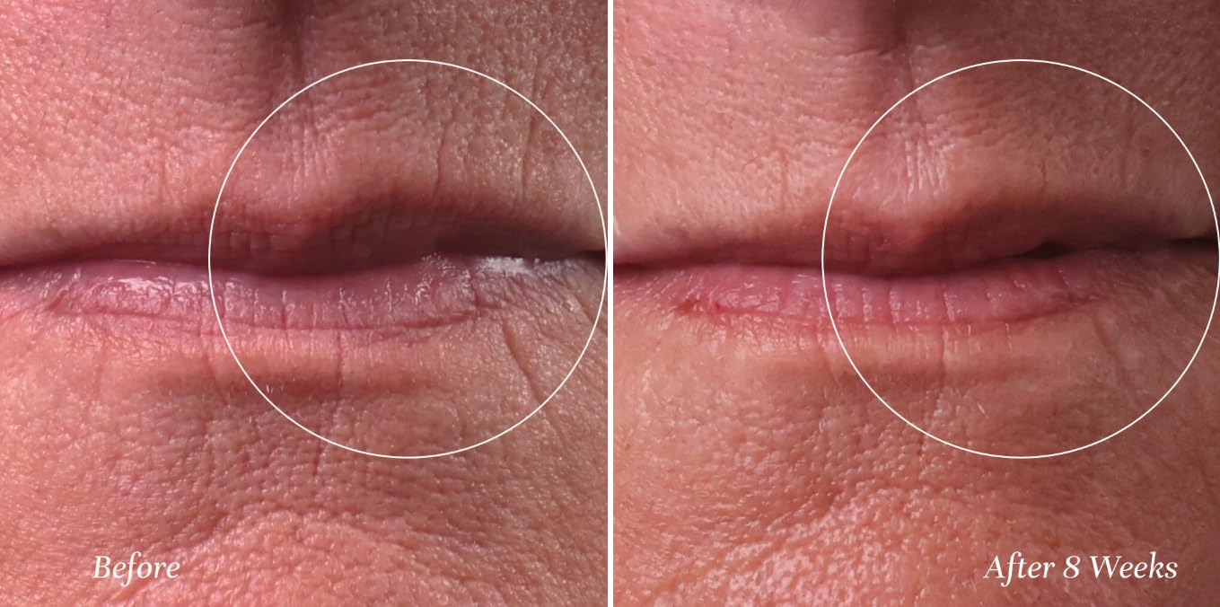 City Beauty Line Therapy close-up of cream texture delivering hydration