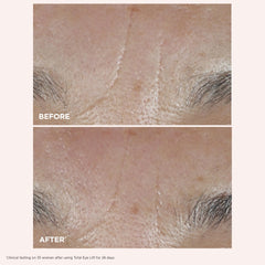 Clarins Total Eye Lift before and after swipe highlighting visible lift
