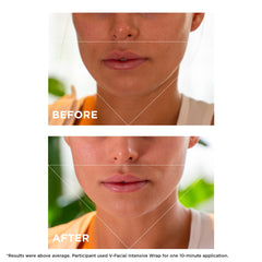 CLARINS Beautyberry and Ginger ingredients staged to highlight botanical actives