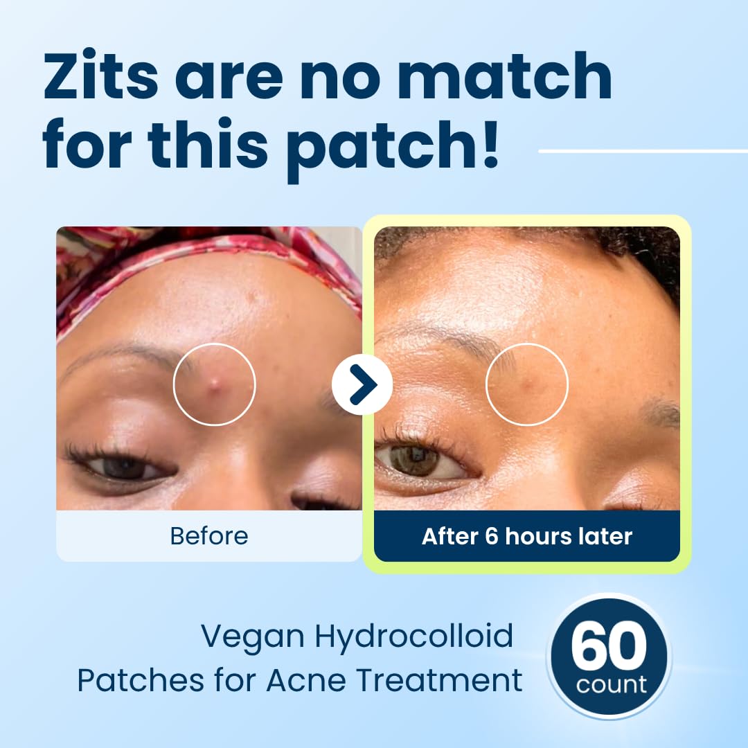 CLEAN SKIN CLUB patch applied to cheek demonstrating discreet coverage