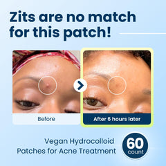 CLEAN SKIN CLUB patch applied to cheek demonstrating discreet coverage