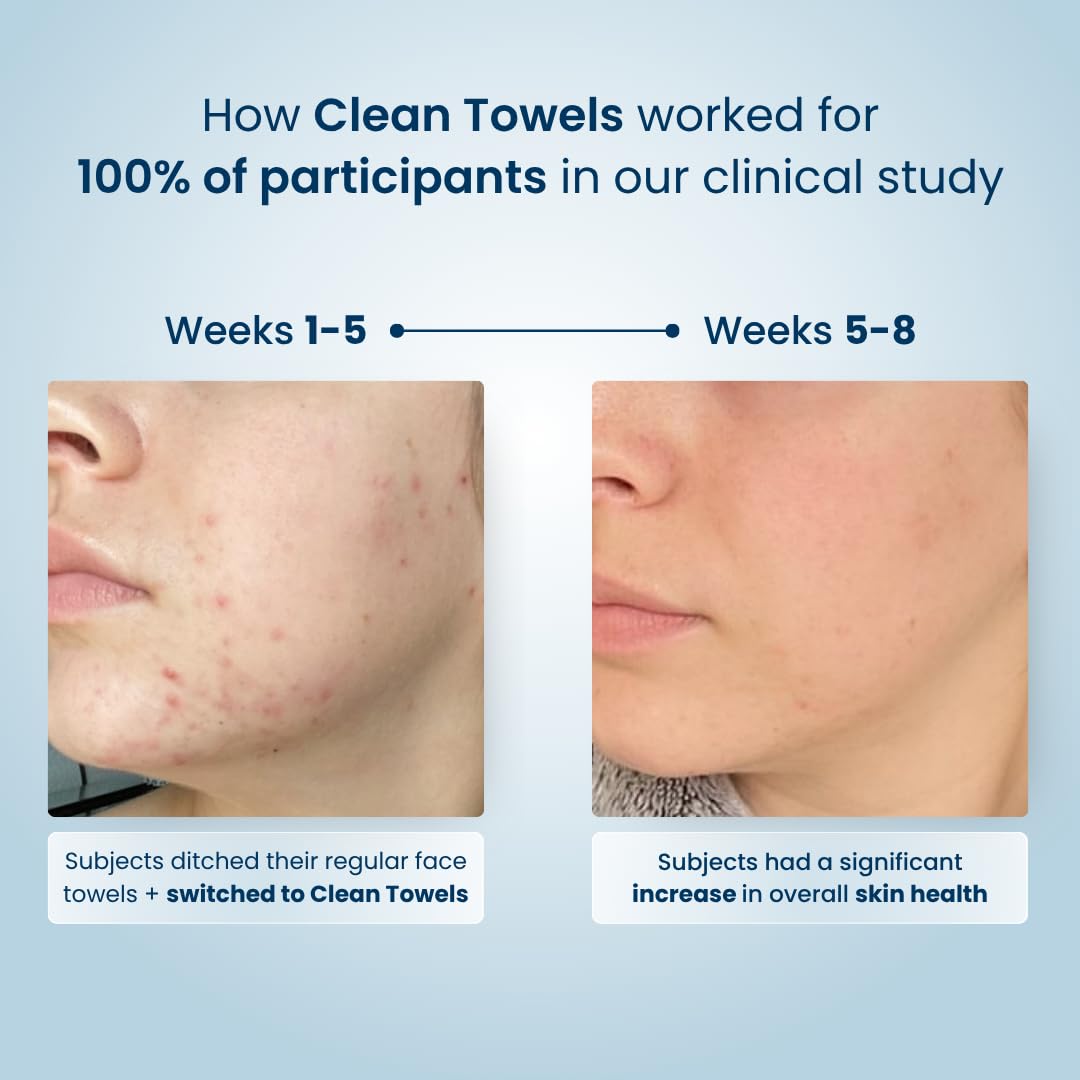 Clean Skin Club towel edge detail showing durable, lint-free finish for gentle use