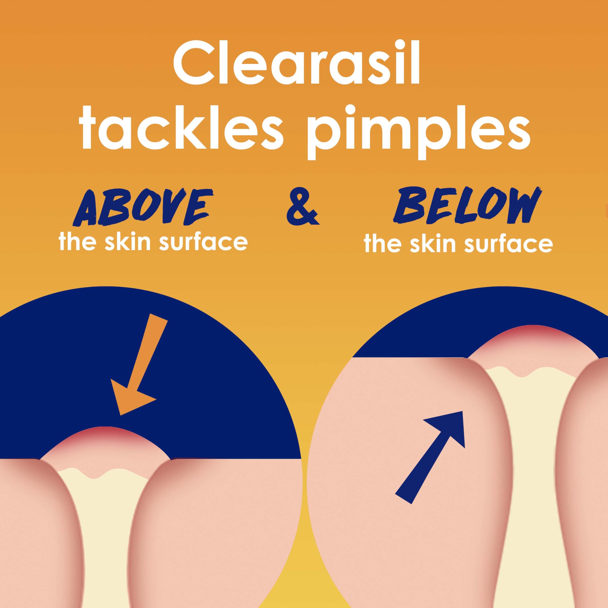 Clearasil pad soaked in solution highlighting salicylic acid treatment