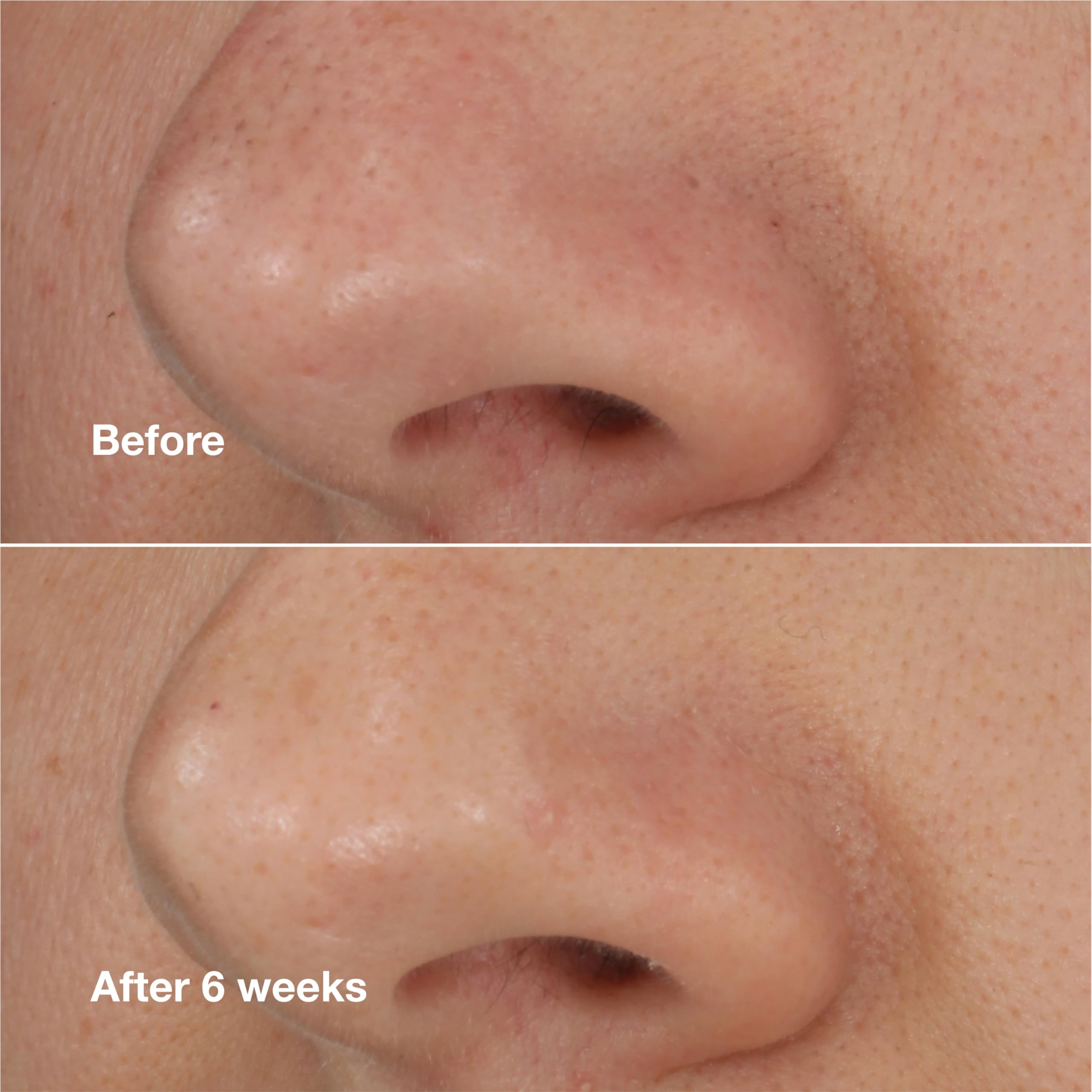 Clinique tube beside a coin to show 0.68 fl oz size for travel-friendly convenience