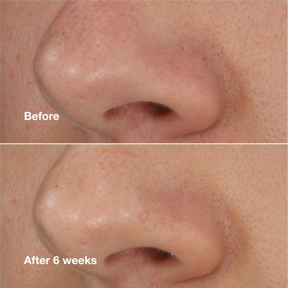Clinique tube beside a coin to show 0.68 fl oz size for travel-friendly convenience