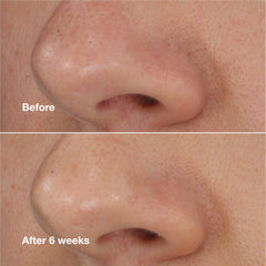 Clinique tube beside a coin to show 0.68 fl oz size for travel-friendly convenience